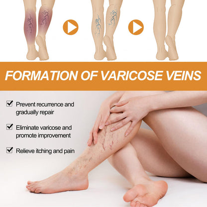 Varicose Veins Care Spray - Buy 1 Get 2 Free