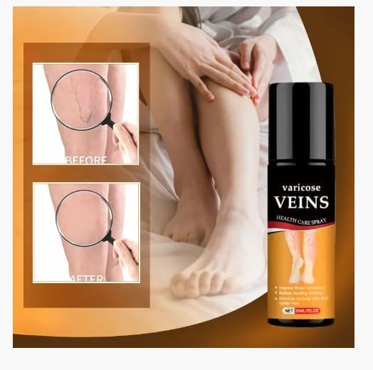 Varicose Veins Spray (Buy 1 Get 1 Offer)