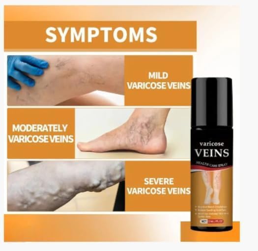 Varicose Veins Spray (Buy 1 Get 1 Offer)