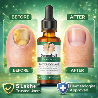 Nail Repair Serum (BUY 1 Get 1 FREE)