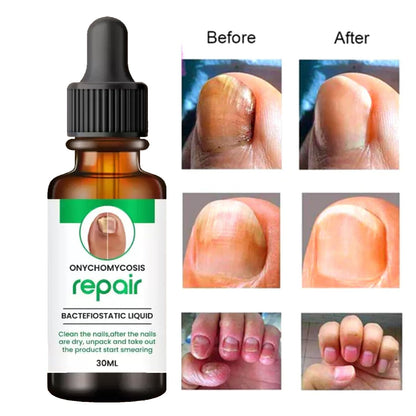 Nail Growth & Repair Serum